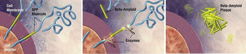 1024px-Amyloid-plaque_formation-big