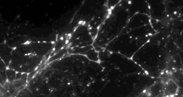 Shown: Electrically stimulated dopamine release in mouse brain, activating 20% of synapses. (credit: Sulzer Lab/Columbia University Medical Center)