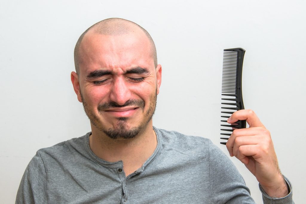 One theory behind male baldness: Excess DHT.