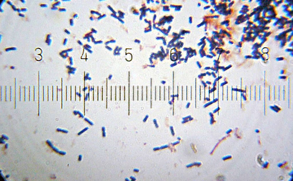 Lactobacillus acidophilus.