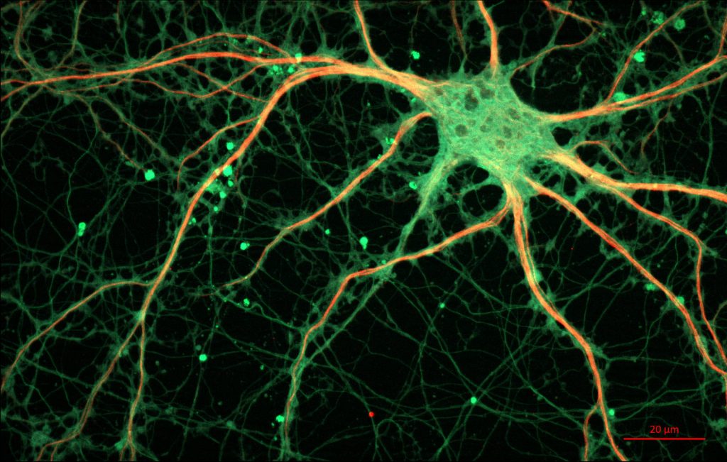 rat hippocampal neuron