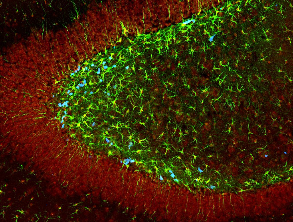 bromodeoxyuridine (brdu) staining neuron cells brain
