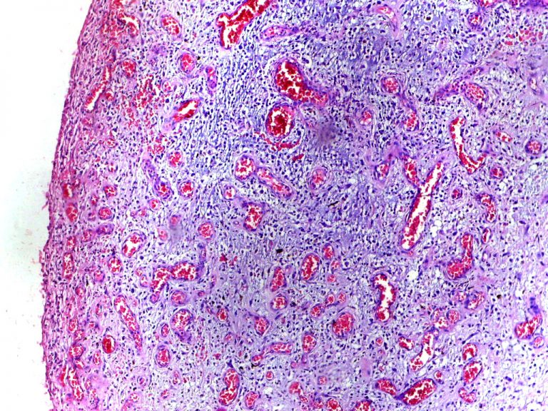 Psychobiotics Probiotics for the Brain Supplements in