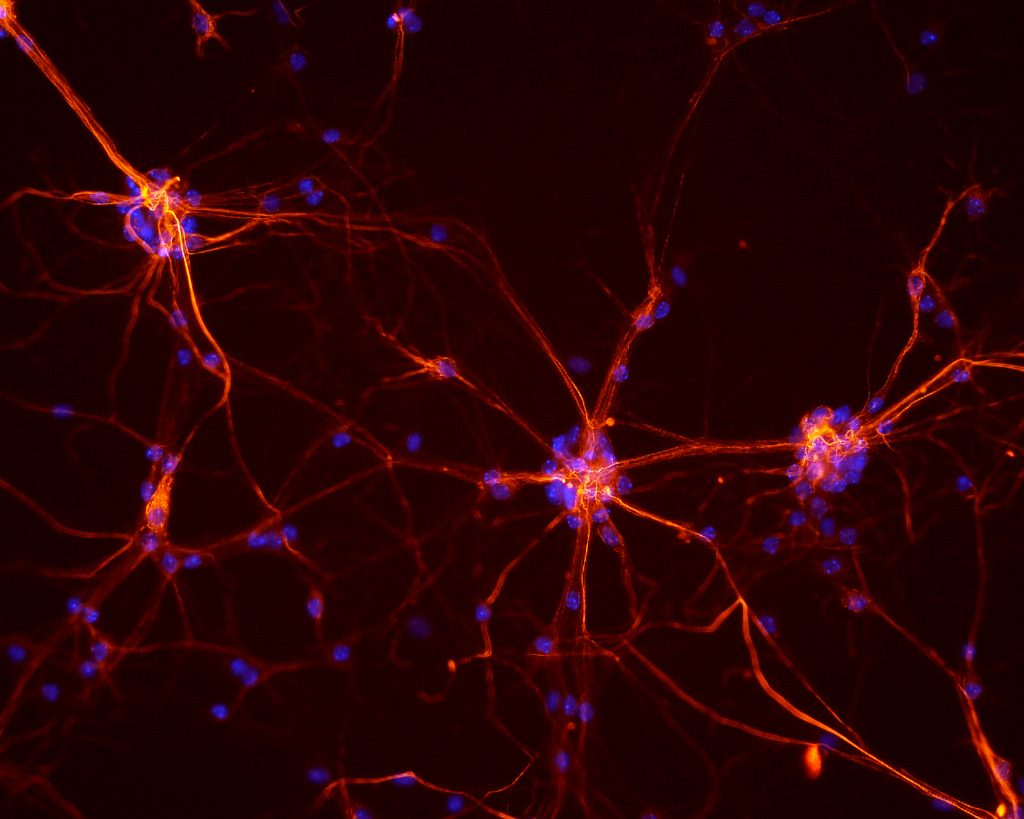 mouse neurons