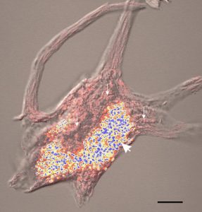 Pictured: A neuron from the spinal cord; yellow structures are the lipofuscin granules that centrophenoxine may help keep in check. By David L McIlwain, Victoria B Hoke [CC BY 3.0], via Wikimedia Commons