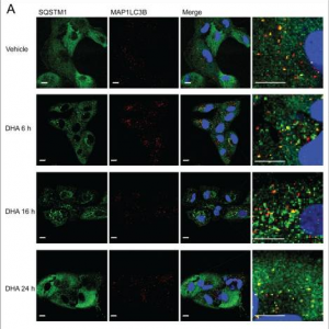 SQSTM1 increases over time after DHA application.