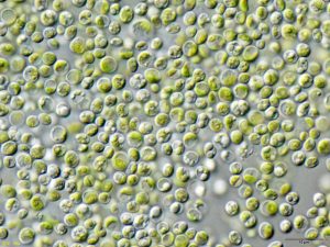 Chlorella vulgaris algae under the microscope.