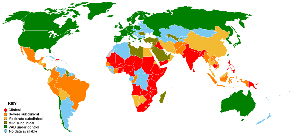 Worldwide vitamin A deficiency. Public Domain, Link