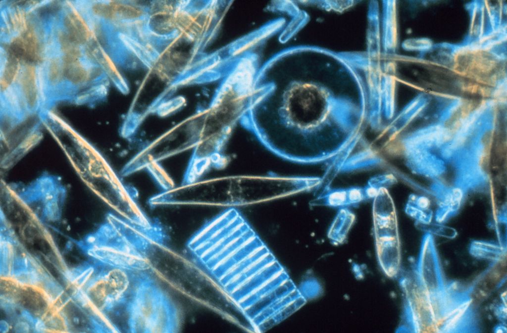 1024px-Diatoms_through_the_microscope