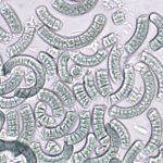 Spirulina under microscope