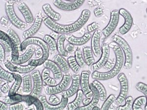 Spirulina under microscope