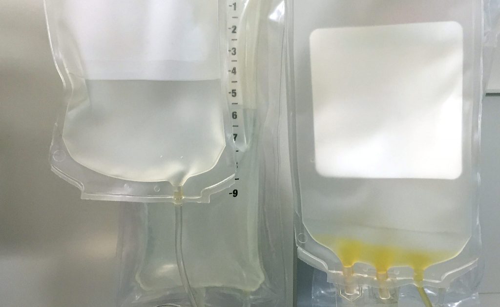 Banana Bags Review Multivitamin IV Drips and Supplement Drinks