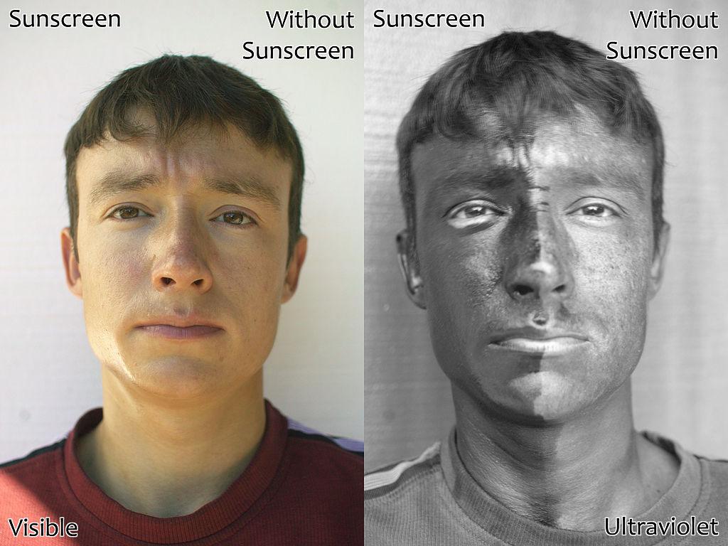 ultraviolet light sunscreen skin